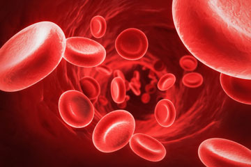 Sepsis