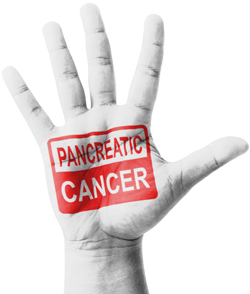 Pancreatic Cancer
