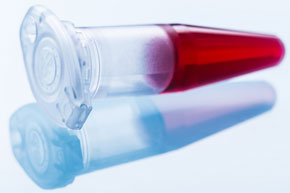 Blood Test
