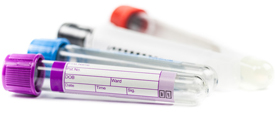 VACUETTE® Blood Collection Tubes