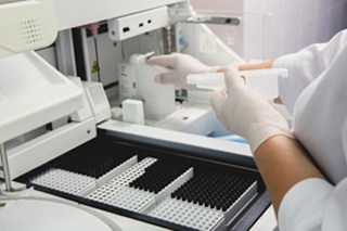 Clinical Chemistry Analyzer Market Growth