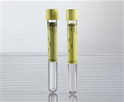 Urine Collection Tube