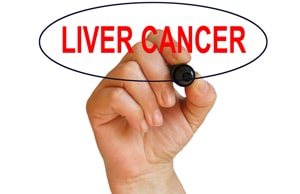 Liver Cancer Treatment