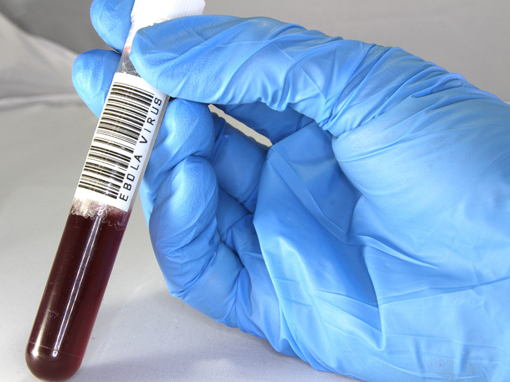 Ebola Zaire rRT-PCR Test