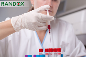 Randox Bowel Cancer Test