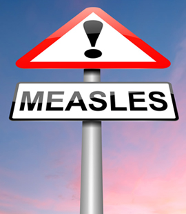 Measles