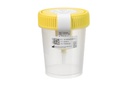 Greiner Bio-One Urine Cup w.int. Transfer Device sterile