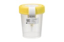 Greiner Bio-One Urine Cup w.int. Transf Dev non-sterile